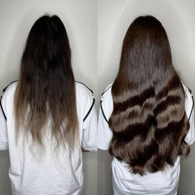Before and after hair regrowth transformation